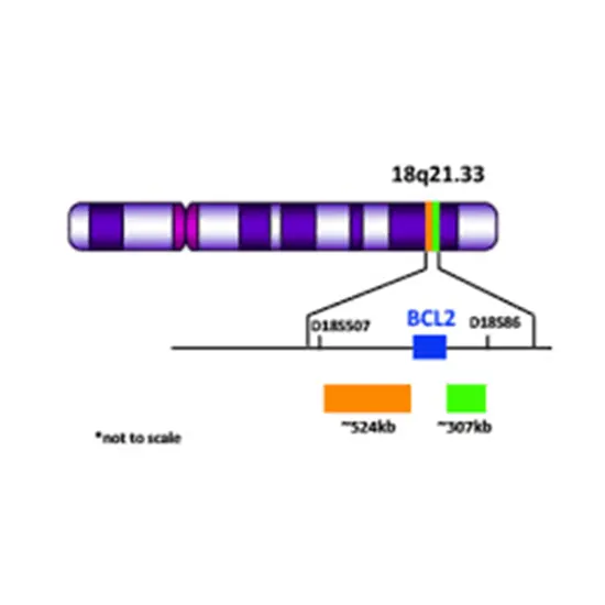 BCL2 (18q21.3) Gene Rearrangement